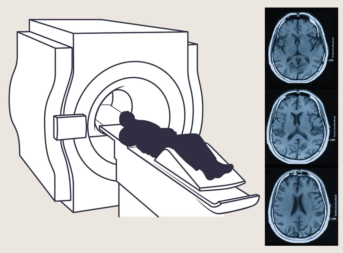 MRI-scan