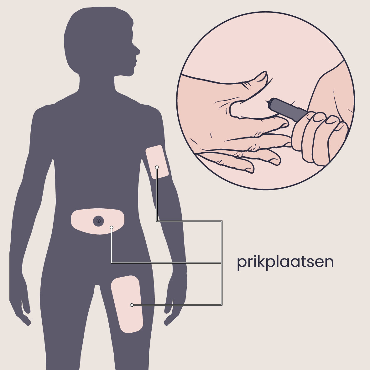 Prikpen voor medicijn