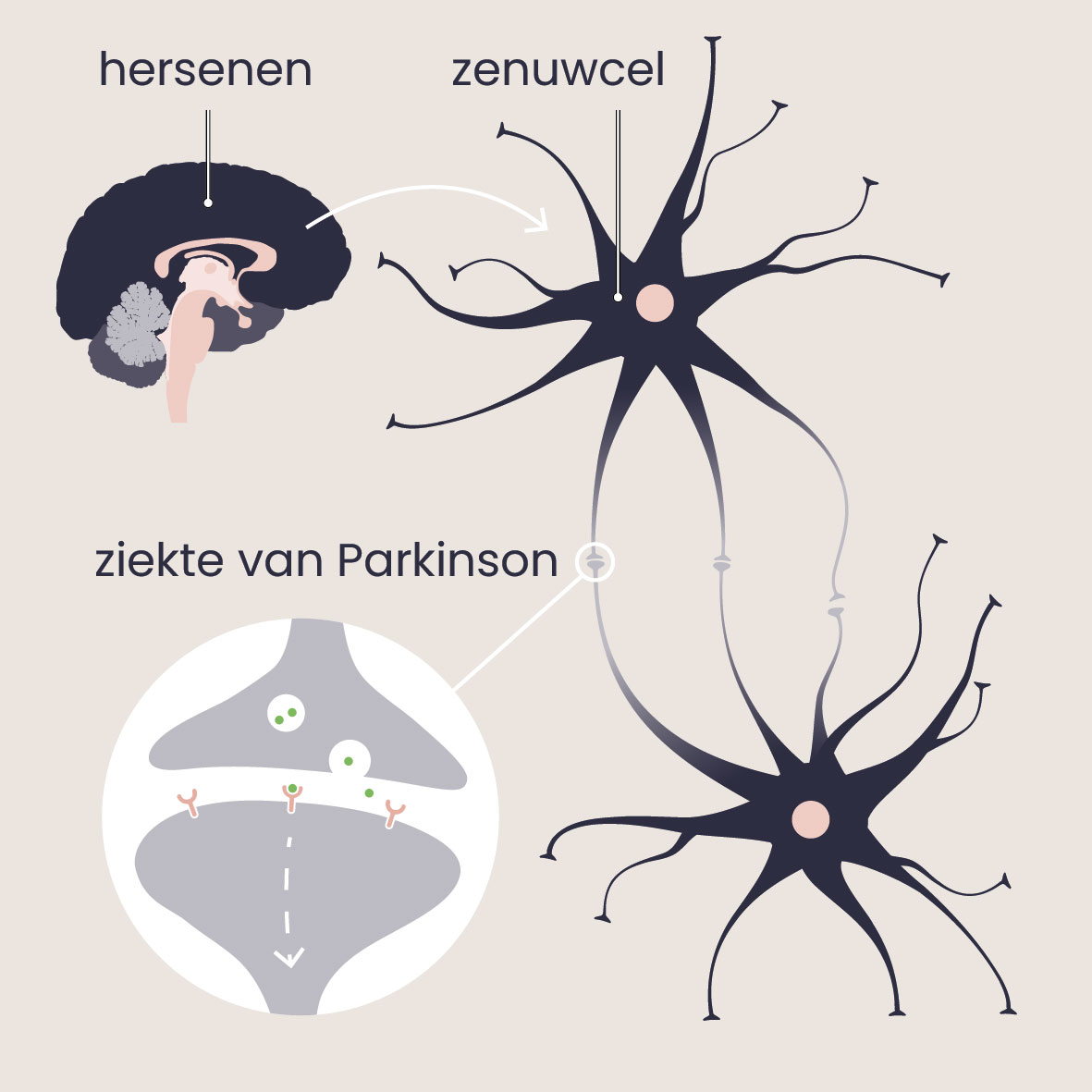 Bij de ziekte van Parkinson is er te weinig dopamine in de hersenen.