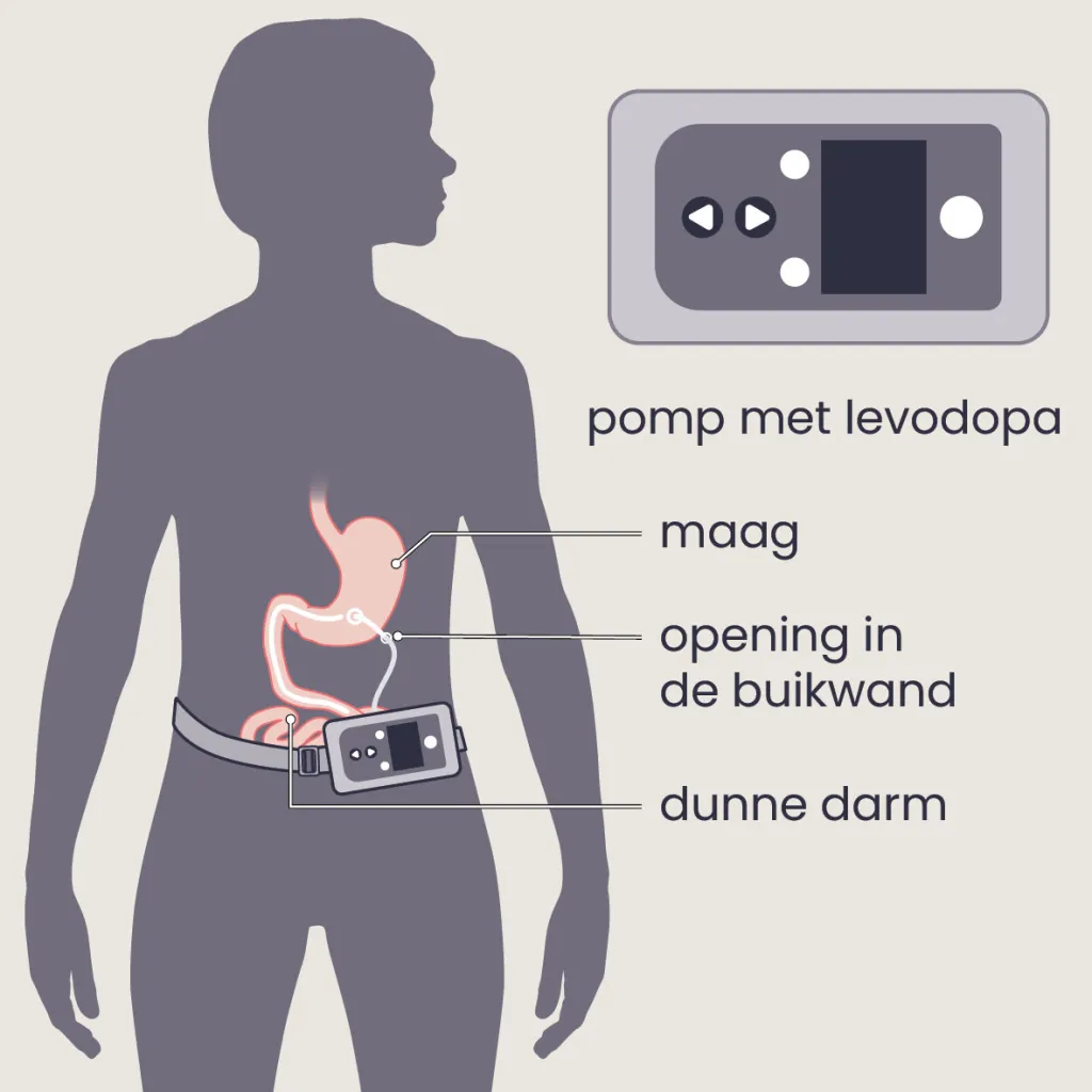 Levodopapomp darm